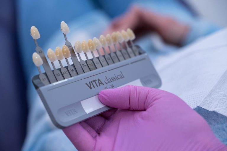 VITA classical A1-D4 shade guide