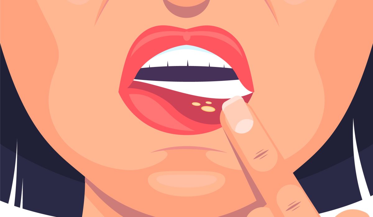 VsExXtjbmIi4EQVnCnjpkVoWXRa17YdxKag12Mjy